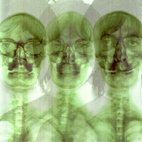 Supergrass