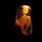 Alice in Chains: Nothing Safe: Best Of The Box