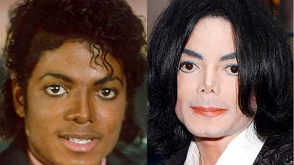 Can Michael Jackson's Bizarre Quirks Be Explained by a Medical