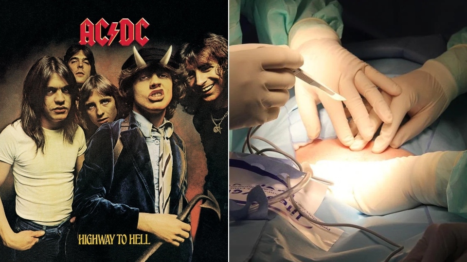 Listening to AC/DC Makes Surgeons Both Faster and More Precise, Study ...
